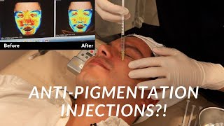 Injections for Dark Pigmentation  Seoul Guide Medical [upl. by Roti]