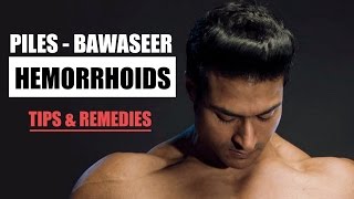 How to cure Hemorrhoids  Piles बवासीर  Tips amp Remedies by Guru Mann [upl. by Sotsirhc]