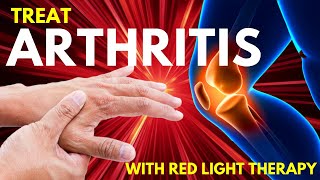 How to Treat Osteoarthritis Using Red Light Therapy [upl. by Sailesh396]