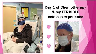 Day 1 of AC chemotherapy amp my TERRIBLE cold cap experience [upl. by Fitalludba]