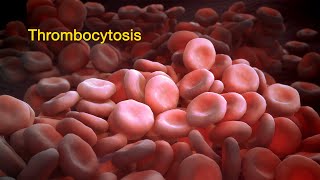 High Platelet Count Causes What is Thrombocytosis [upl. by Tilney]