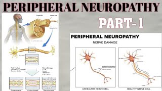 PERIPHERAL NEUROPATHY  PART1  WALLERIAN DISTAL AXONAL DEGENERATION amp SEGMENTAL DEMYELINATION [upl. by Hnid]