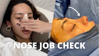 I GOT A NOSE JOB  Rib Rhinoplasty Experience PreOp amp Surgery Day Vlog Part 1 [upl. by Aldred]