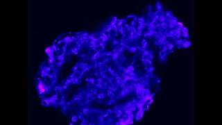 Calcium efflux fluo3 from a glomerulus Ionomycin [upl. by Attirb]