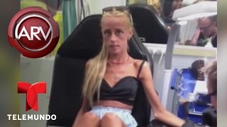 Jovencita a punto de morir de anorexia por lucir modelo  Al Rojo Vivo  Telemundo [upl. by Aed255]