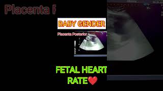 FETAL HEART RATE VS BABY GENDER shortsfeed shorts [upl. by Hardner638]