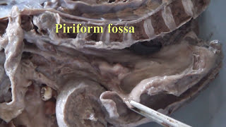 Anatomy labMedian Section of Head and Neckcadaver specimen by DrGosai [upl. by Allmon]