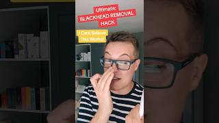 Ultimate BLACKHEAD REMOVAL HACK  Blackhead Plucking shorts [upl. by Lebiram634]