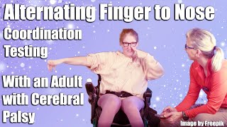 Alternating Finger to Nose Coordination Testing with an Adult with Athetoid Cerebral Palsy [upl. by Harding456]