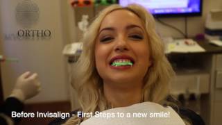 MY INVISALIGN TREATMENT EXPERIENCE  The Start of My Teeth Transformation [upl. by Keeton5]