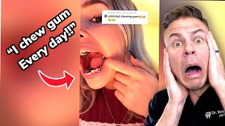 Orthodontist Reacts Chewing Gum With Braces [upl. by Parnell311]