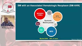 Diagnosis and management of systemic mastocytosis whats new in 2024 [upl. by Bel77]