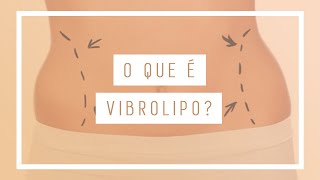 Vibrolipo Conheça A Lipoaspiração Menos Invasiva l Dr Leandro Gontijo [upl. by Orgel808]