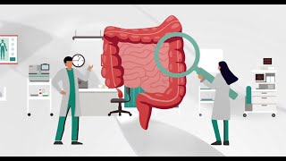 Colorectal Cancer Screening Fecal Immunochemical Test FIT  OCSENSOR [upl. by Enetsirk]