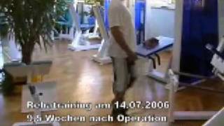 Video 3 von 6 Hüft op Hüfte Operation Oberflächenersatz nach McMinn linke Hüfte [upl. by Boorman]