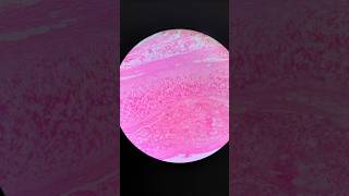 Microscopic view of Cartilages Histology mbbs aiims bhubaneswar [upl. by Allrud]