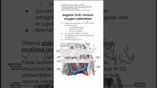 Jugular bulb venous oxygen saturation [upl. by Fredi878]