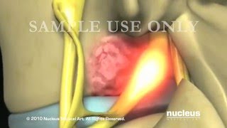 Nucleus Spine Demo Reel 2010 [upl. by Nicolau642]