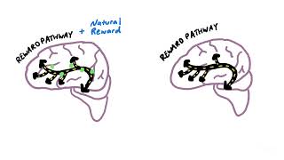 How an Addicted Brain Works [upl. by Pierette]