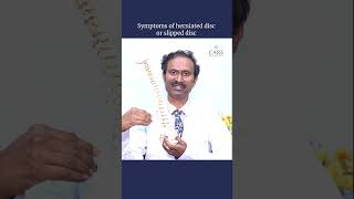 Symptoms of Herniated Disc  Dr Anand Babu Mavoori  CARE Hospitals Musheerabad [upl. by Notslah]