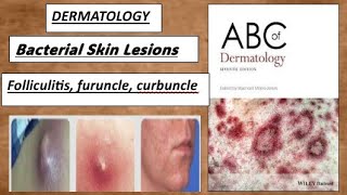 DERMATOLOGY  Bacterial skin lesion  folliculitis furunclecurbuncle derma lesion [upl. by Ahcorb]