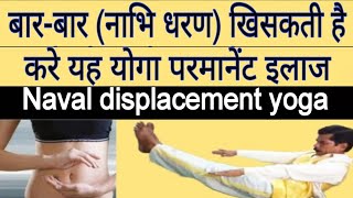 Naval displacement  Nabhi dharan  Treatment At Home With Yoga [upl. by Ahsirkal]