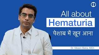 Hematuria  Peshaab main Khoon  पेशाब में खून कारण और उपचार [upl. by Eednak]