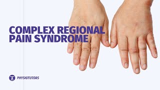 Complex Regional Pain Syndrome  CRPS  Wrist amp Hand [upl. by Scribner]