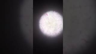 gram negative coccobacilli under microscopic ll blood culture ll microbiology [upl. by Shrier]