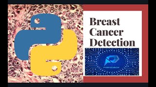 Breast Cancer Prediction Using Machine Learning  Python [upl. by Ennylhsa418]