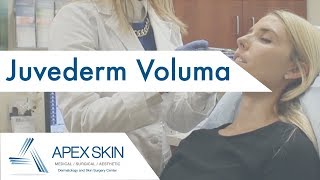 Juvederm Voluma FAQ [upl. by Ransom701]