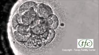 Human Embryo Growing from Fertilization to Day 6 Blastocyst [upl. by Acinoda]