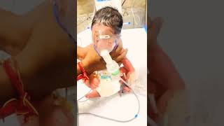 Nebulizer nebulization newbornbaby ivcannula funny sad viralvideo shorts venger [upl. by Anead]