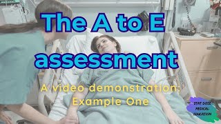 The A to E assessment Example One [upl. by Suiratnauq]