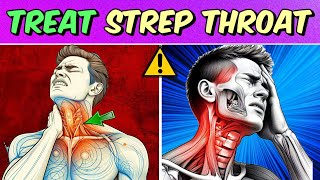 How to treat strep throat infection Home remedies for strep throat [upl. by Ynahpit]