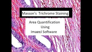 How to Measure different Colored Area in Images Using Image J Software [upl. by Ytsihc900]