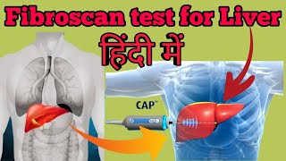 What is Fibroscan Test for Liver Explained in Hindi  Use Price and Normal Range [upl. by Susana364]