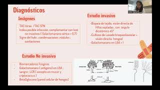 INFECTOLOGÍA 11 Infecciones Fúngicas [upl. by Gentille351]