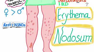 Erythema Nodosum [upl. by Kared]