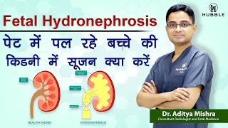 Fetal Hydronephrosis पेट में पल रहे बच्चे की किडनी में सूजन क्या करें [upl. by Noslen672]