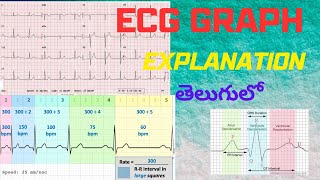 Explain about ECG Graph  How to calculate Heart rate  How to understand ECG ecg heartrate [upl. by Madian]