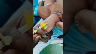 Infant Cannula insertion😱🔥😡safecaretrending motivation [upl. by Longley]