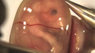 Isolation and injection of an E155 mouse embryo [upl. by Gnouhp]