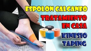 Tratamiento de espolón y fascitis plantar en casa con kinesio cinta [upl. by Ahsilac]