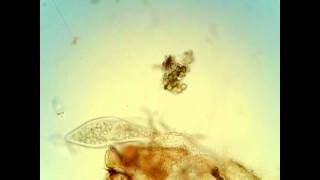 Coleps and paramecium [upl. by Elwaine227]