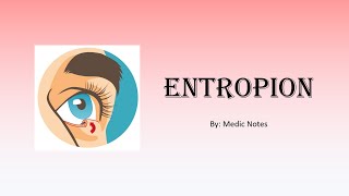 Entropion causes complications treatment and management [upl. by Octave]