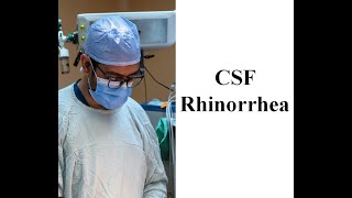 OMFS CSF Rhinorrhea [upl. by Yael]