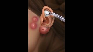 Asmr ear cleaning [upl. by Pazit]