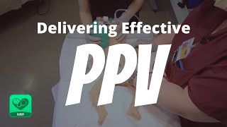 Delivering Effective PPV for Neonatal Resuscitation  NRP Mastery for Nurses [upl. by Acinet]