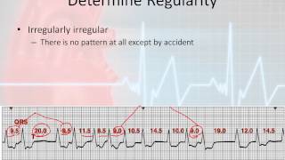 Basic Rhythm Interpretation parr 5  The Systematic Approach 3 [upl. by Yrahca927]